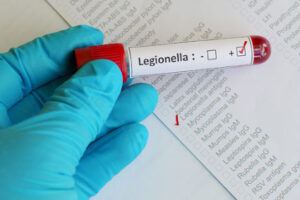 Recognition, Evaluation and Control of Legionella